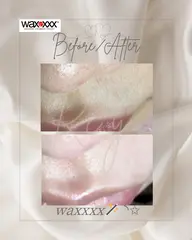 鼻下wax脱毛