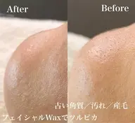 フェイシャルワックス(高保湿パック付)