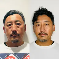 【メンズ限定】👨minimo限定✨脅威の効果実感率100%ビューティーライザー¥18000→¥10000