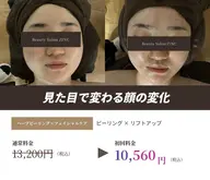 ハーブピーリング✖️フェイシャルケア