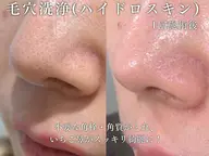 【口コミ特典限定★】 毛穴洗浄(全顔) 3,980円