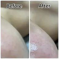 【女性】スーパーフードフェイシャルワックス