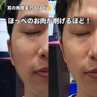 【小顔エステモニター】