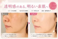 【シミ・毛穴・くすみケア】フォト光×美容液導入