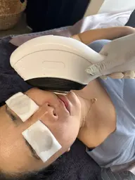 お顔のみ脱毛🤩