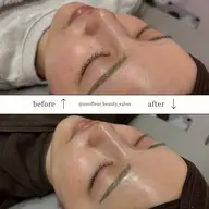 【エステメニューを迷われた方はこちら】カウンセリング後にメニューを決定⭐︎６０分枠をお取りします！※料金変動あり
