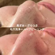 【初回】毛穴洗浄+ハーブピーリング🌿黒ずみ・ざらつきをまとめてケア