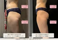 ✨【美脚・美尻】下半身集中痩身60分✨太もも・ふくらはぎ・ヒップを徹底ケアでシンデレラボディへ大変身✨¥3980