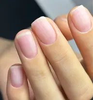 ケアのも