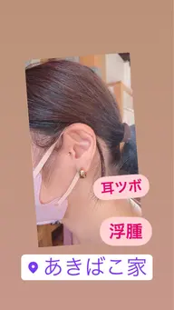 ヒト幹細胞培養液スプレー+耳ツボジュエリー💎