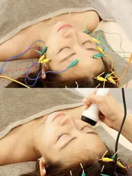 迷ったらこれ!【フェイスラインケア/Vライン美人】 電気美容鍼+強力EMS+首肩頭皮スパ🪞✨