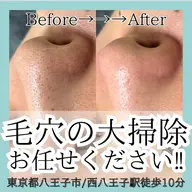 \ミニモ学割/人気No.1メニュー❣️【💆🏻♀️毛穴洗浄コース💎】
