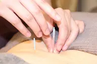 【頭痛・肩こり・慢性疲労】🪷鍼灸整体コース🪷60分