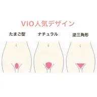 VIO脱毛(メンズNG)