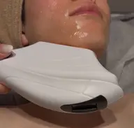 メンズ髭脱毛