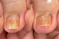 フットケア👣