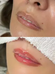 【消えないリップ】タトューでもアートメイクでもない新技術1回👄