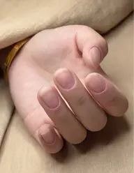 自爪オフ