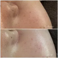 【7月限定】艶肌フェイスWAX(眉毛込み)+水光パック