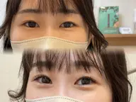 上フラットラッシュ80本 / 下まつげエクステ30本