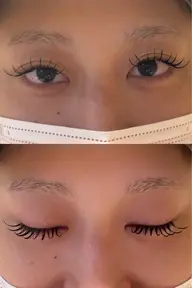 バインドロック80束
