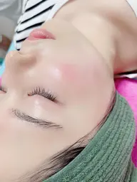 【美容鍼】肌質集中ケア50分 メンズも大歓迎【酷いニキビ/肌荒れ/クレーター肌/肌質/潤い肌が欲しい/艶肌】