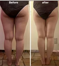■ 骨盤深部筋膜リリース➕美脚コルギ60分Massage the fat and muscle of the feet