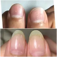 深爪でお悩みの方🌱自爪育成メニュー(育成オイル込み)