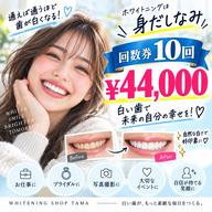 🦷通うほど白い歯へ✨セルフホワイトニング10回券¥44,000💕