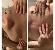 筋膜リリース 70分コース