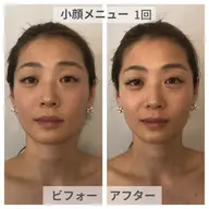 【小顔3Dリフト】50分💎ラジオ波で温め&ハンドでほぐす!即効むくみオフ×立体フェイス✨