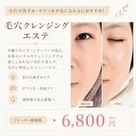 【黒ずみ毛穴洗浄】ザラつき除去毛穴クレンジングエステ