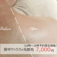 女性/【14時​〜​16時予約限定】背中ワックス脱毛×光脱毛14時​〜​16時予約限定¥9,000→¥7,000