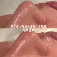 【初回】毛穴洗浄✨黒ずみ・角栓・毛穴のざらつきが気になる方に