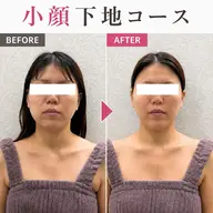 \10月限定500円🍂/【むくみ/たるみ】鏡を見るのが楽しくなる!筋膜リリース×小顔ケア✨¥20,900→¥500🤍