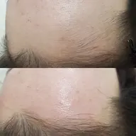 おでこWAX💆✨