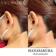 【ミニモ特価】うなじワックス脱毛