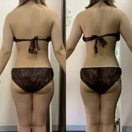 🎀ブライダル🎀美しいドレス姿に👗《ハイパーナイフ✖️美背中&二の腕集中痩せ🔥》