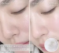 韓国肌管理/浮き出る毛穴洗浄