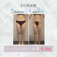 【痩身/全身】ハイパーナイフ90分