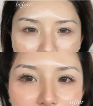オフ込みフラットラッシュ140本