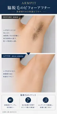 🔷メンズ 脇