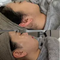 フェイスシェービング