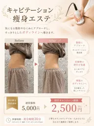 キャビテーション