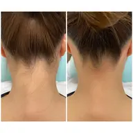 うなじワックス👱🏻♀️🩷(光脱毛とセットの場合+¥3300)来年時にお申し付けください🥰