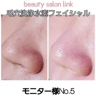 🫧期間限定🫧ミニモ限定メニュー🙆毛穴の大掃除！水素毛穴洗浄フェイシャル✨韓国生パック付きでプルプル♪50分
