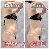 【導入モニター】腰回り&お腹集中◆脂肪AI測定×超音波60分