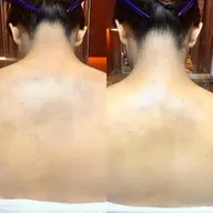 🪻レディースシェービング🪻背中、デコルテ