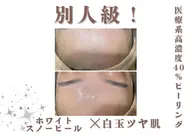 迷ったらコレ❣3連休来店限定🌀フェイシャル・ボディ・脱毛お悩みに合わせてカスタマイズ🫧😶🌫️¥2200