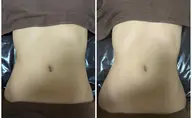 【アロマ×美容整体×EMS】1箇所集60分コース✨リンパ・骨格・筋肉アプローチでトータルケア🫶たるみや引き締めも❣️